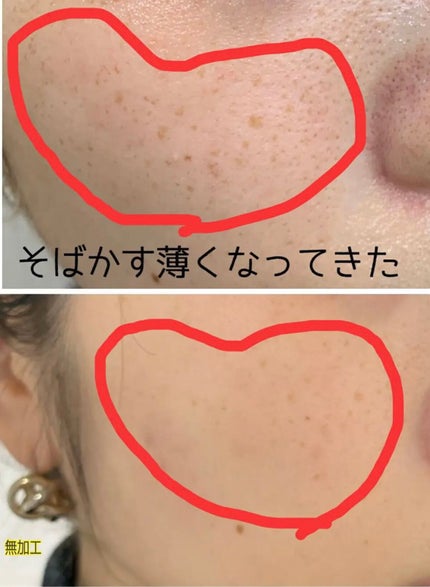 薬用 雪肌精/雪肌精/化粧水を使ったクチコミ(2枚目)