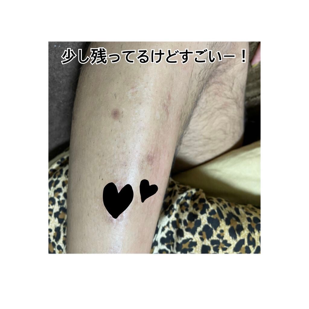 バスタイム除毛クリーム サプレム・エッセンス/Veet/除毛クリームを使ったクチコミ(4枚目)