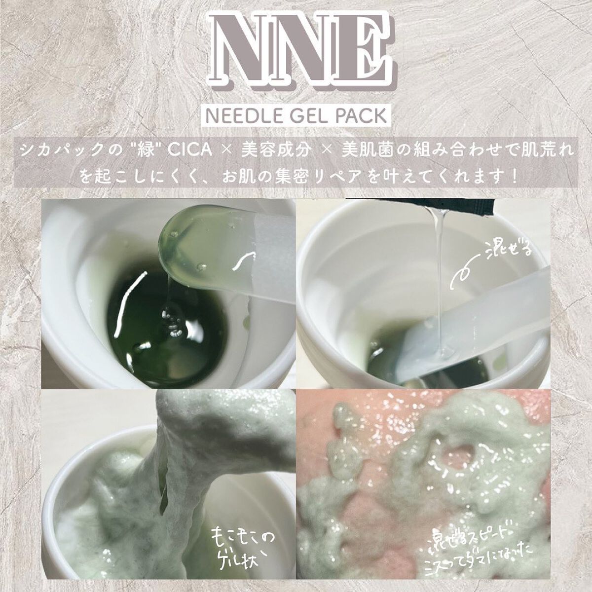 ニードル炭酸パック/NNE/洗い流すパック・マスクを使ったクチコミ(4枚目)