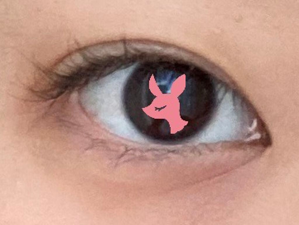 ♡こじか♡ on LIPS 「こんにちは!こじかです!🦌今回は、蒙古襞がある目頭を切開ライン..」(7枚目)