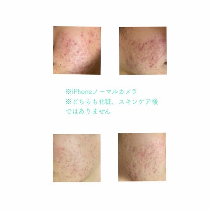 ビジャ シカバーム EX/innisfree/フェイスバームを使ったクチコミ(3枚目)