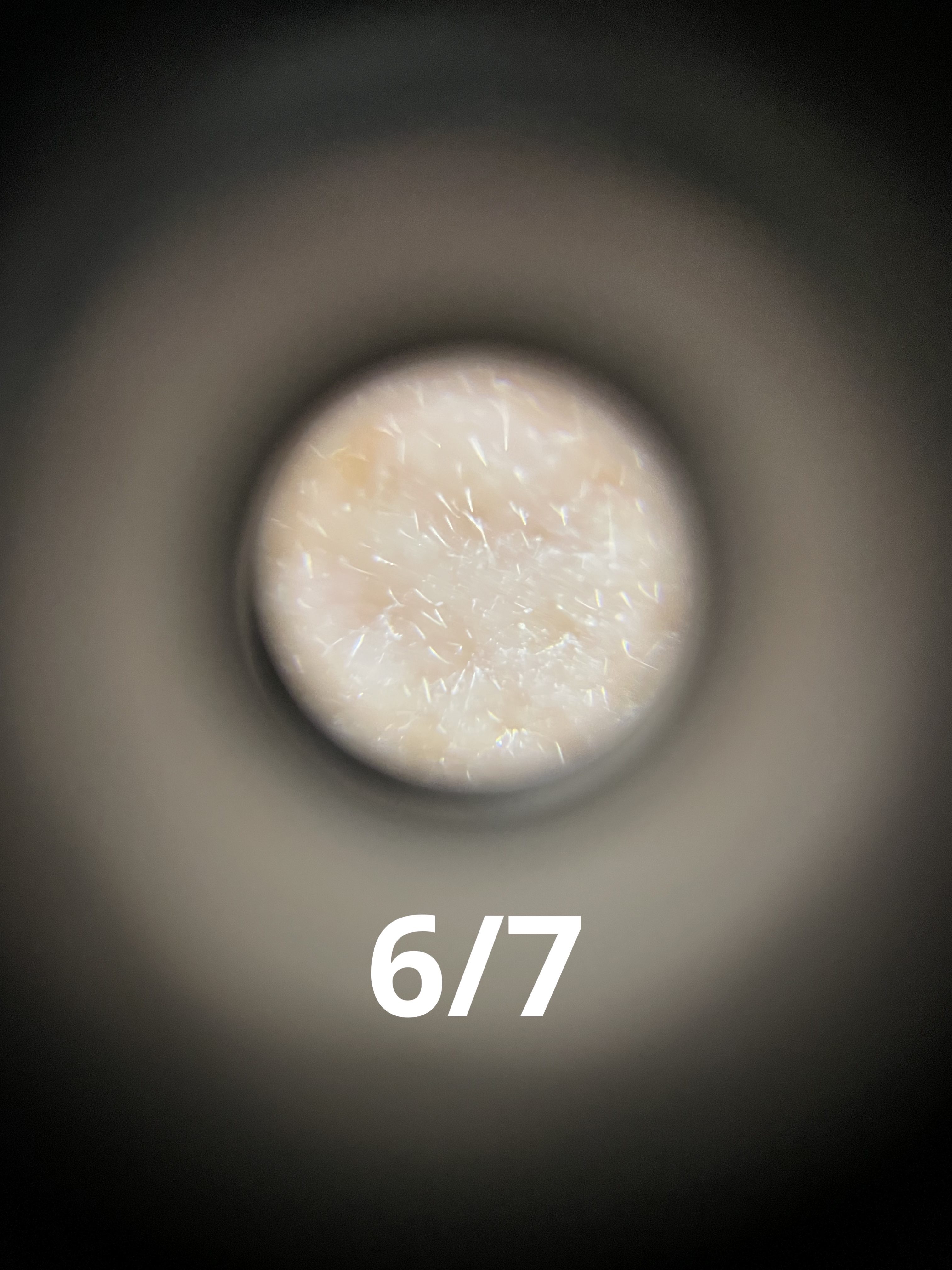 シカレチA エッセンス0.1/VT/美容液を使ったクチコミ（3枚目）