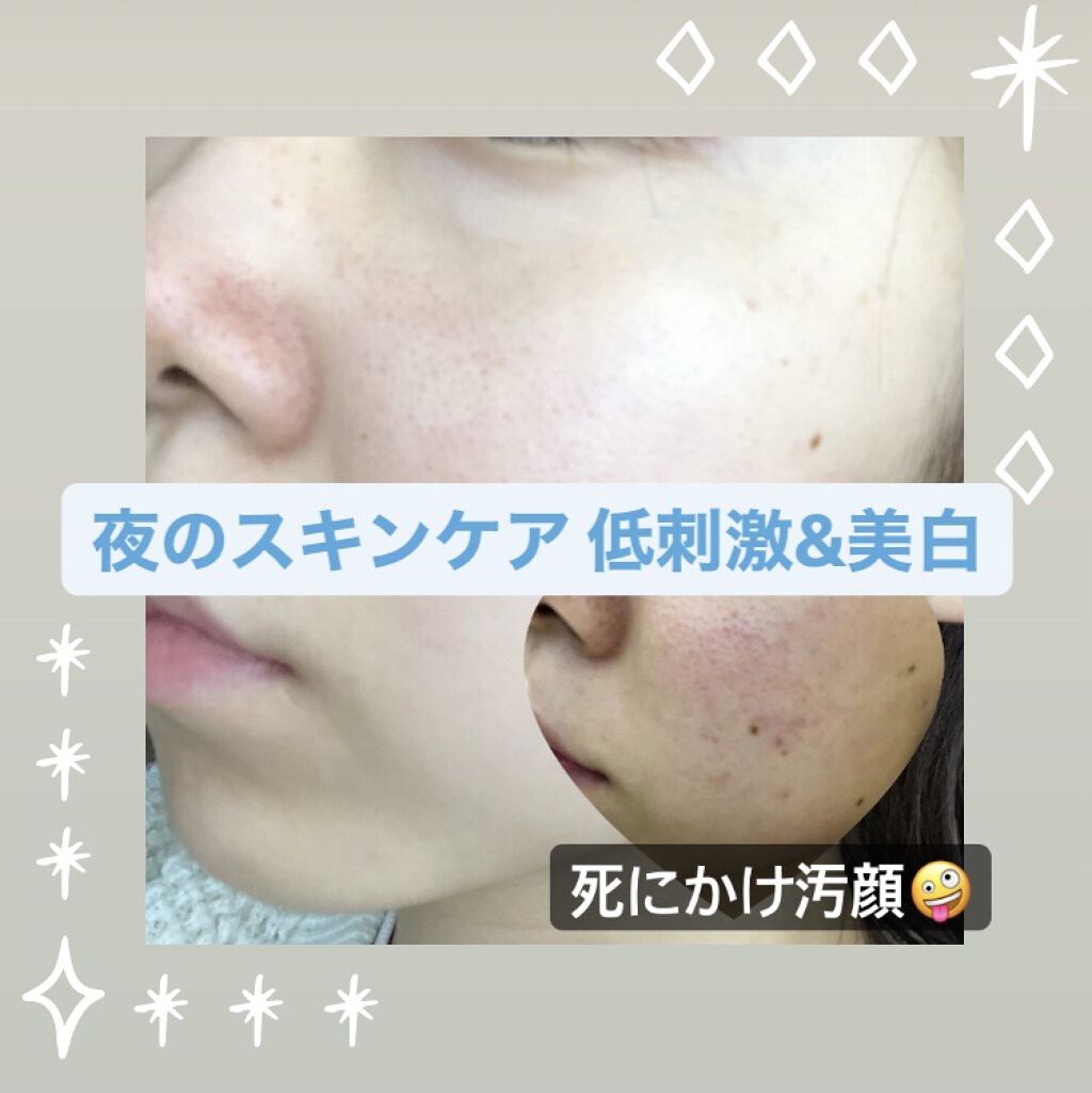 潤浸保湿 化粧水 II しっとり/キュレル/化粧水を使ったクチコミ（1枚目）