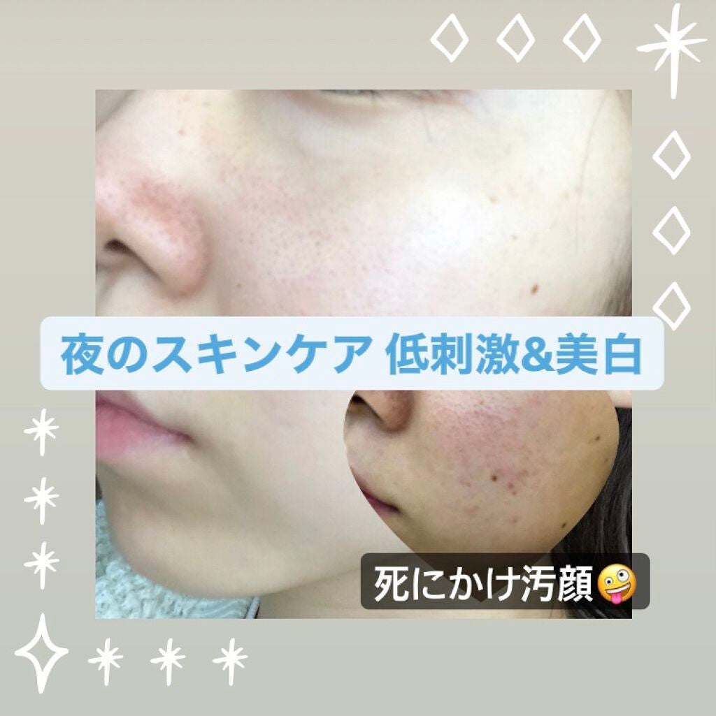 潤浸保湿 化粧水 II しっとり/キュレル/化粧水を使ったクチコミ(1枚目)