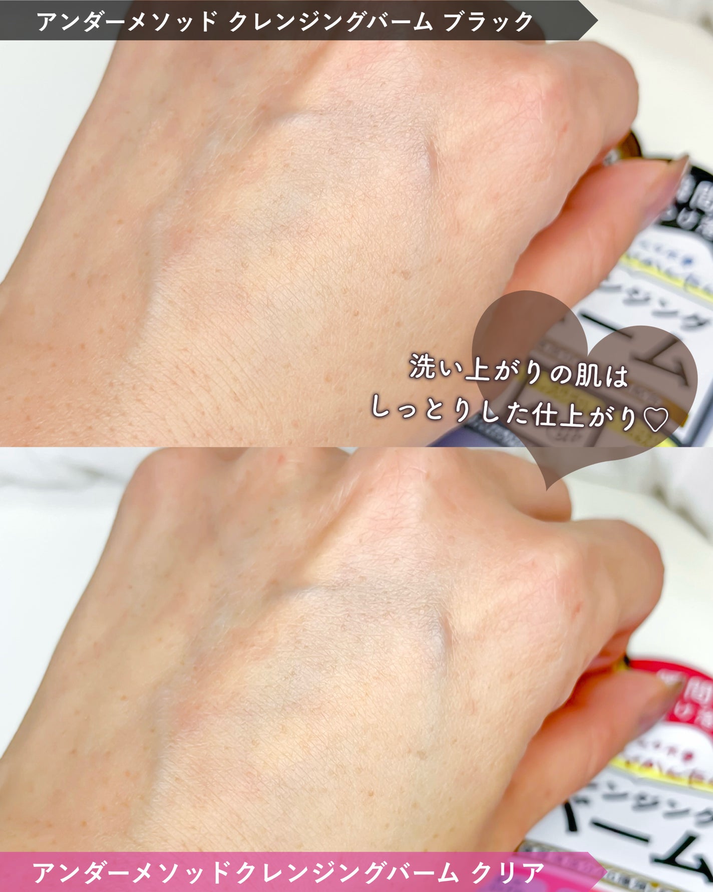 クレンジングバーム ブラック/アンダーメソッド/クレンジングバームを使ったクチコミ(6枚目)