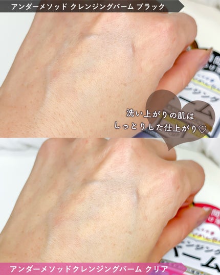 クレンジングバーム ブラック/アンダーメソッド/クレンジングバームを使ったクチコミ(6枚目)