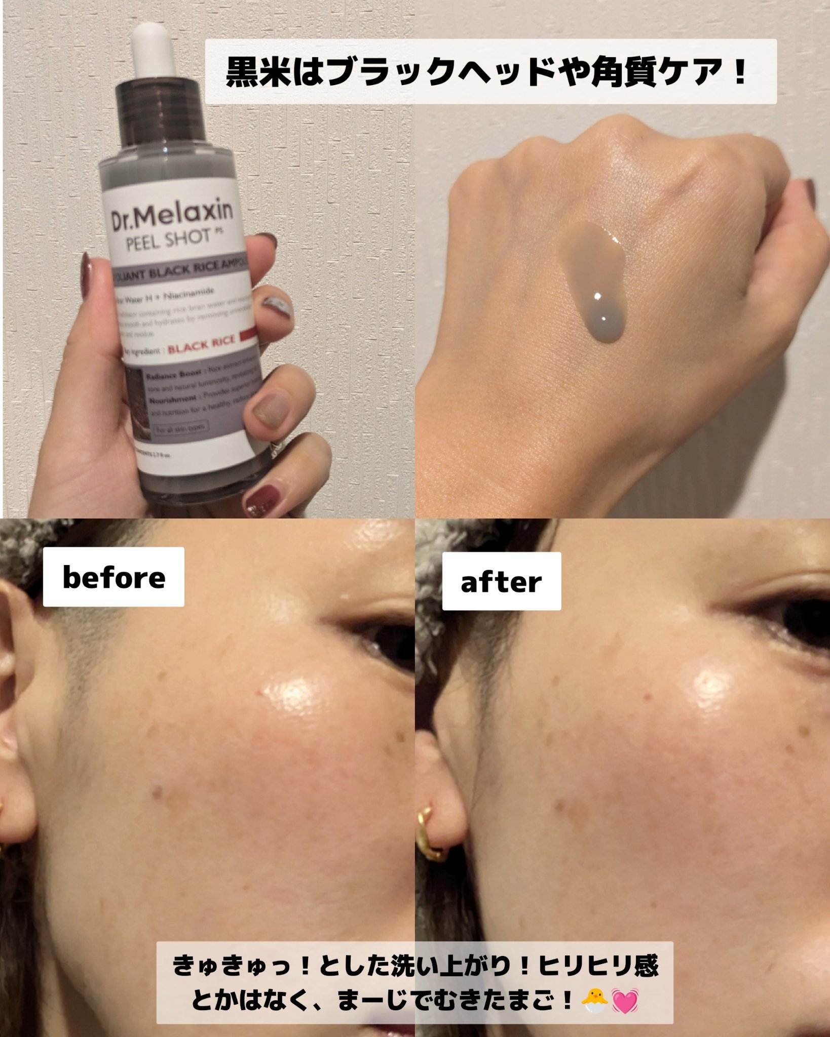 を使ったクチコミ（3枚目）