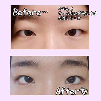 ハイブリッドフィルム/アイトーク/二重まぶた用アイテムを使ったクチコミ(2枚目)