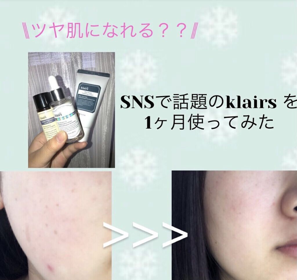 2021 クレアス ベストパッケージ/Klairs/スキンケアキットを使ったクチコミ（1枚目）