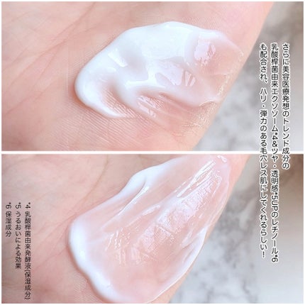 メディダーマ スレッドリフトクリーム/メディダーマ/フェイスクリームを使ったクチコミ(5枚目)