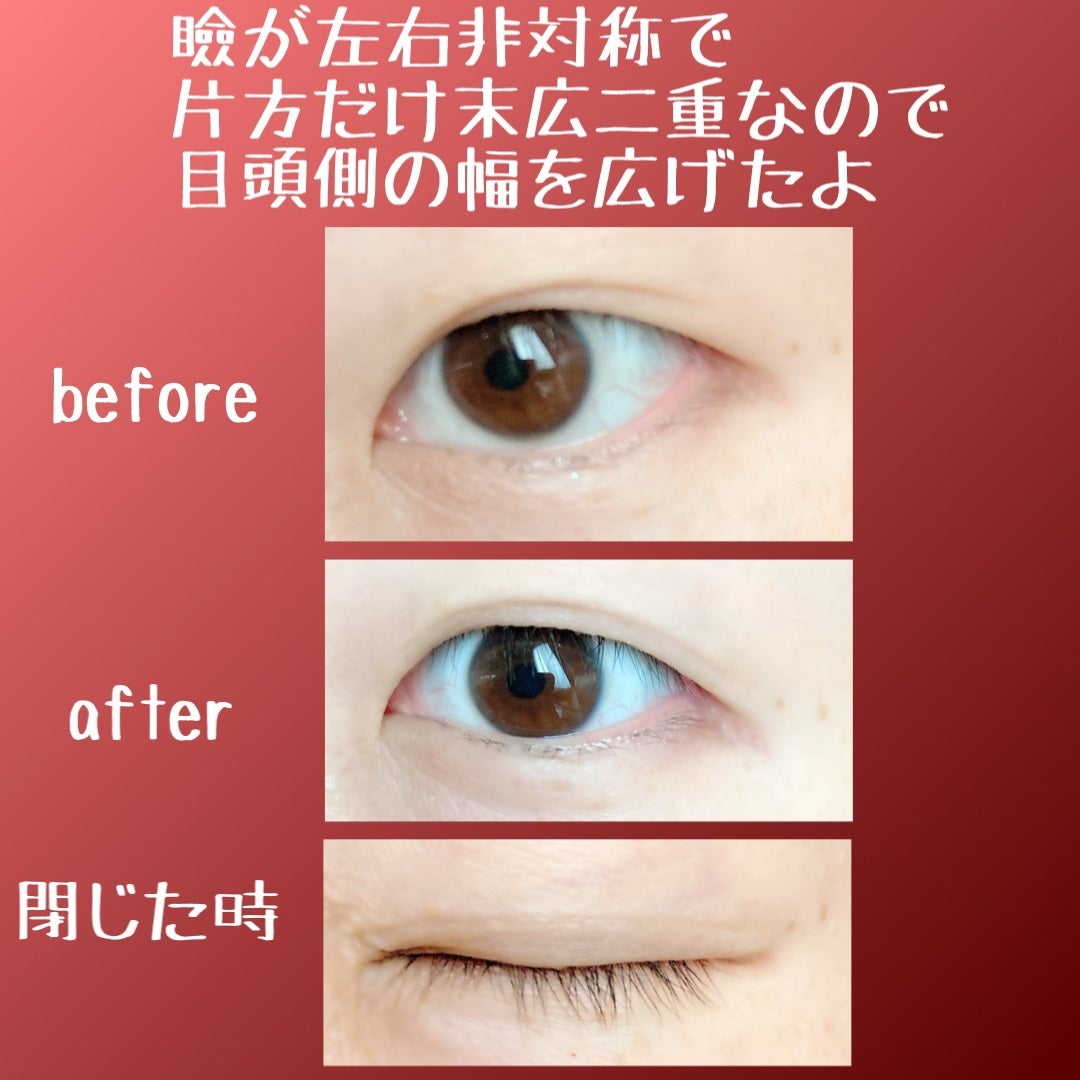 TWOOL ダブルアイリッドグルー/SHOBIDO/二重まぶた用アイテムを使ったクチコミ(4枚目)