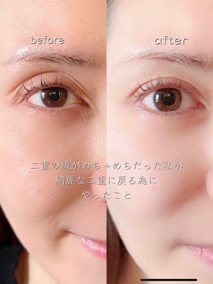 EXプレミアム アイクリーム/Medite/アイケア・アイクリームを使ったクチコミ(1枚目)