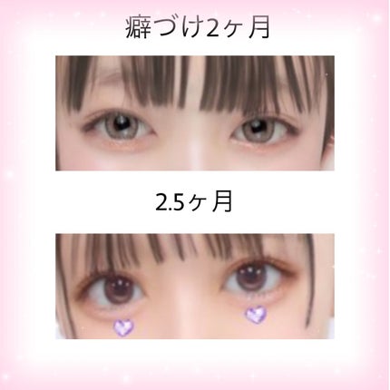 のびーるアイテープ(絆創膏タイプ、レギュラー)/DAISO/二重まぶた用アイテムを使ったクチコミ(4枚目)