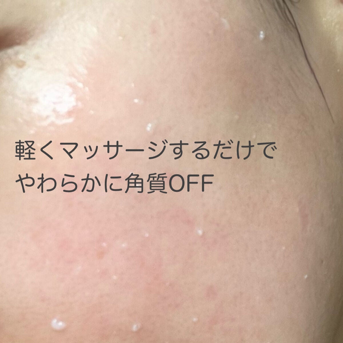フェイシャルマイルドピーリング/primera/ピーリングを使ったクチコミ(3枚目)