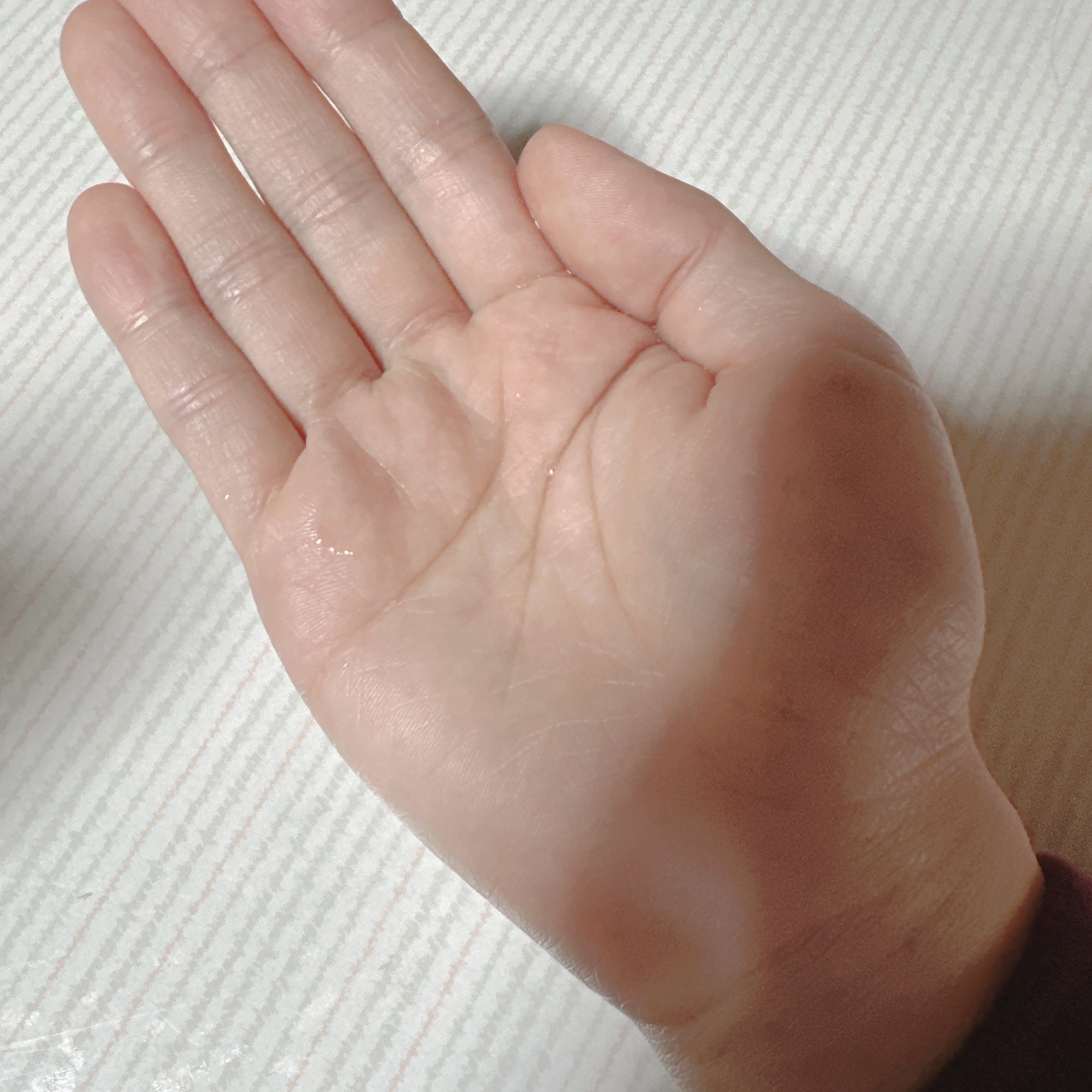 VC100ホワイトローション/クオリティファースト/化粧水を使ったクチコミ（2枚目）