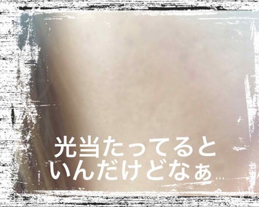 なぁたん☆ on LIPS 「こんにちは☆⚠️2枚目以降、毛穴アップあります💧💧⚠️2枚目の..」（4枚目）