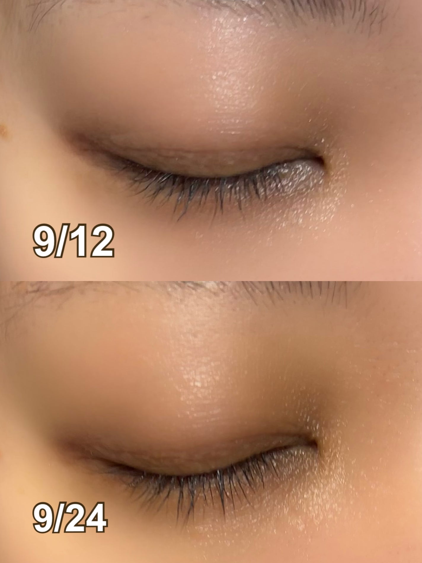 ð¶ããã¡ããð¶ on LIPS ãdeartiqueãã©ã¯ã«ã¢ã€ã©ãã·ã¥ã¢ã³ãã«10ml1æ¥ã«2..ãïŒ4æç®ïŒ