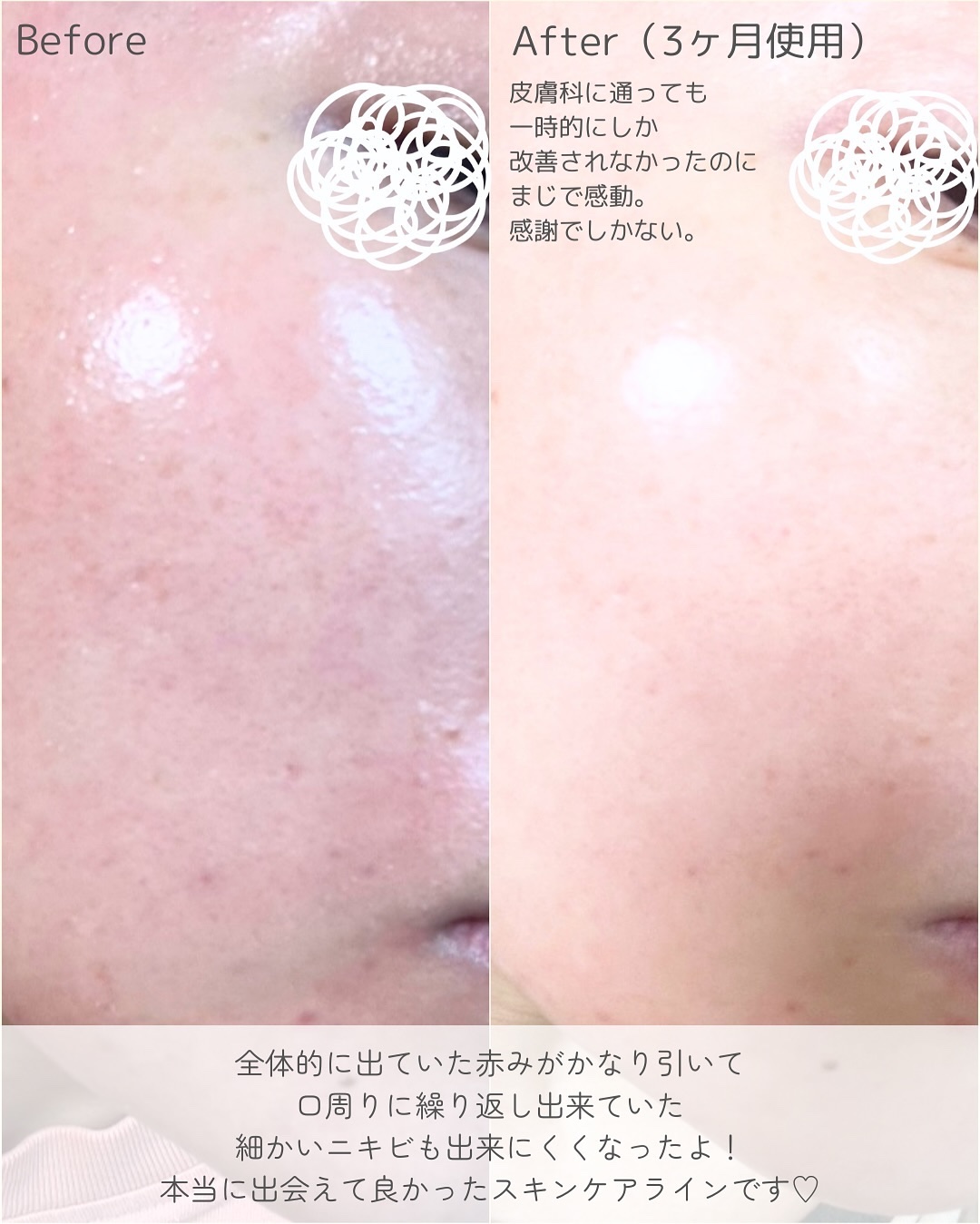 1番 塗るパントテン酸スージングクリーム/numbuzin/フェイスクリームを使ったクチコミ（3枚目）