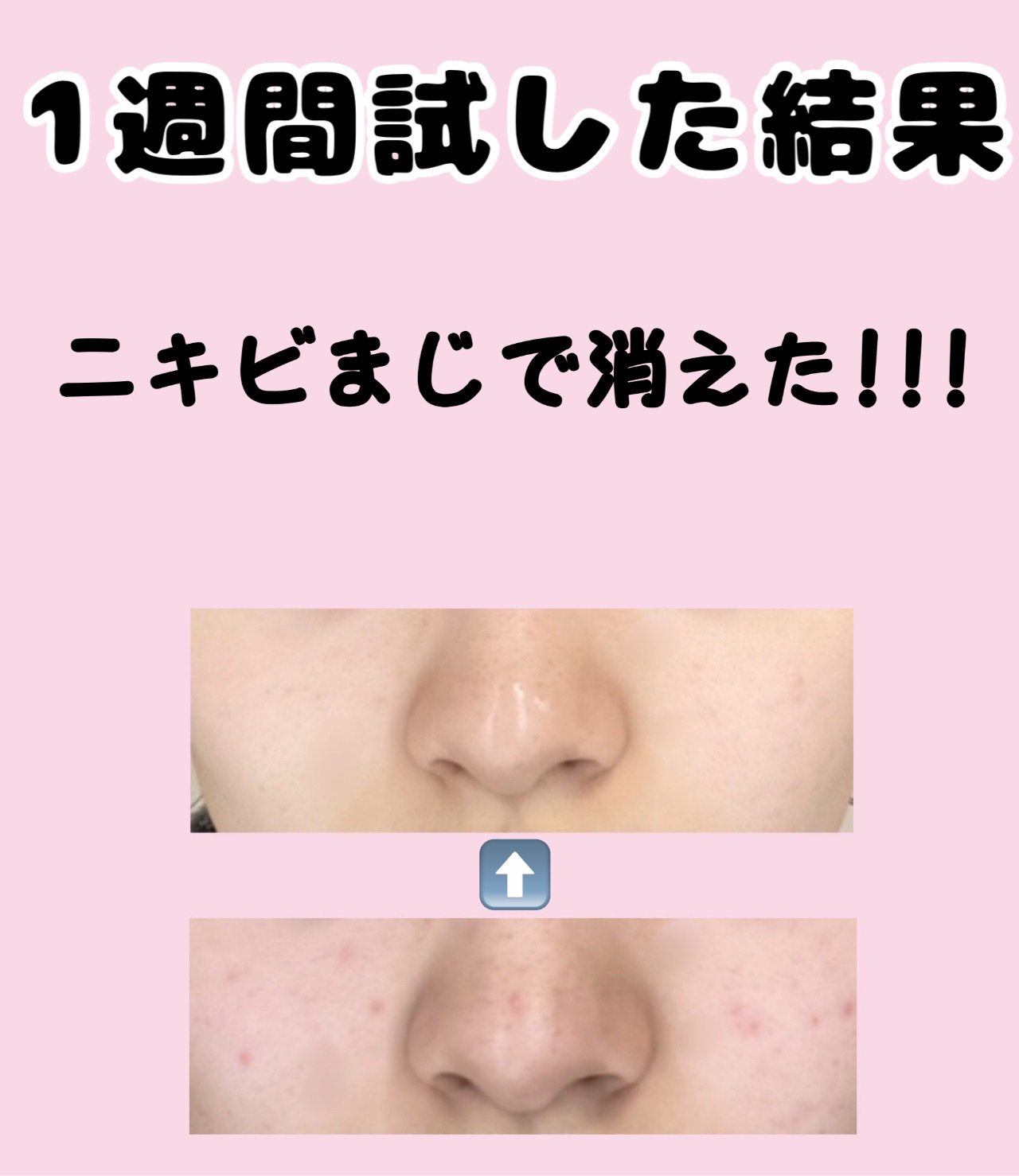 明色美顔水 薬用化粧水 90mL（ブルーロックコラボデザイン）/美顔/化粧水を使ったクチコミ（2枚目）