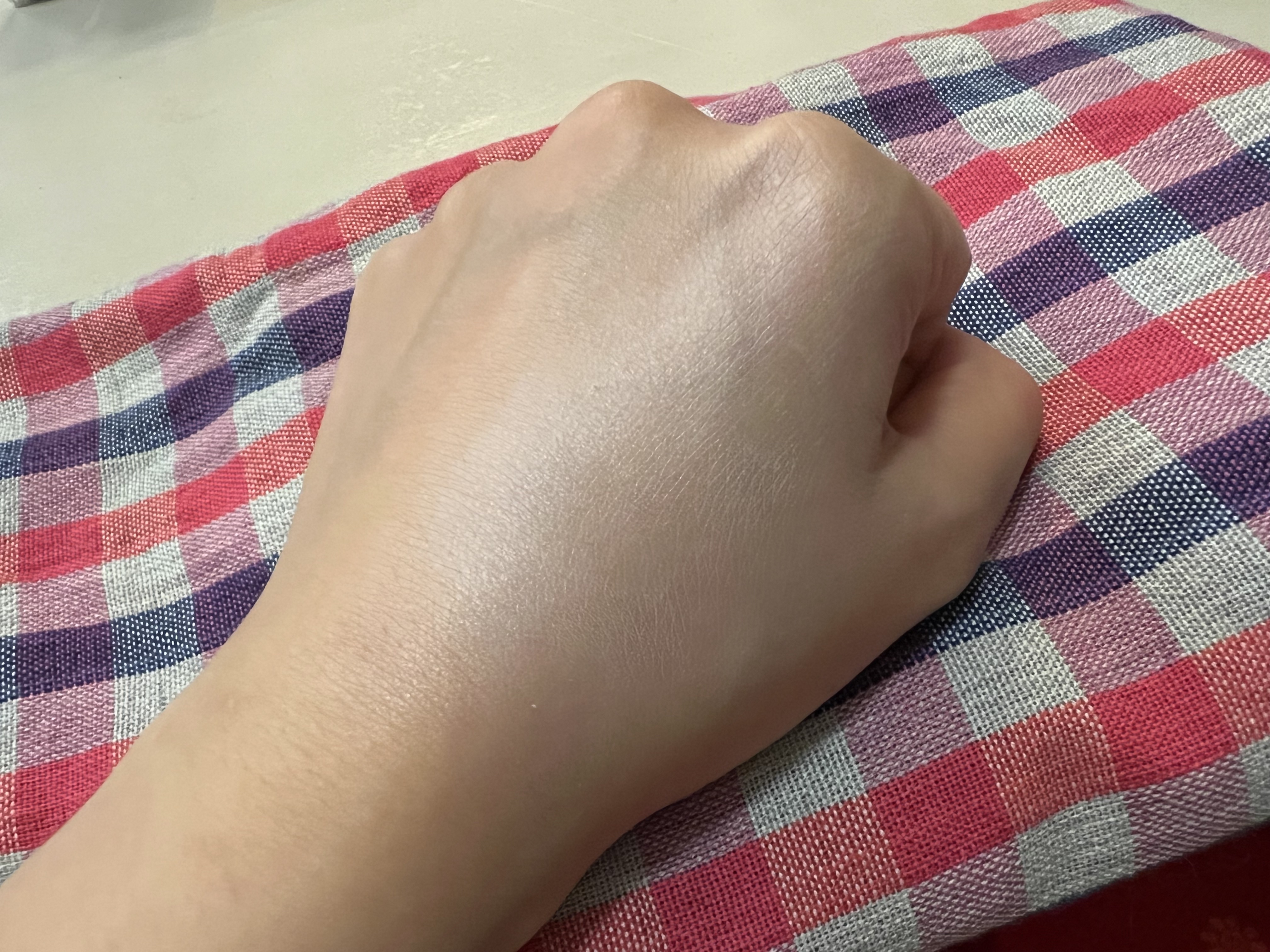 WHOMEE リキッドコンシーラーのクチコミ「転倒して顔面強打した際に頬骨周りに痣が出来てしまいました…

痣が青紫から黄色に変わった時、手.....」（1枚目）