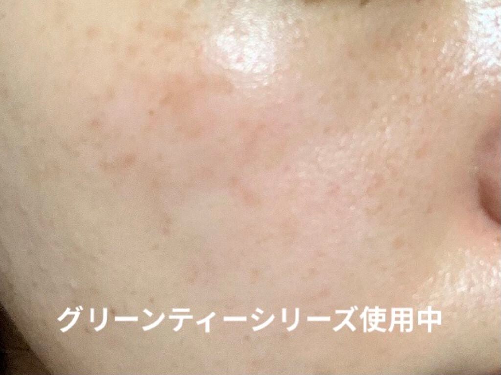 ポメグラネート バイタル エマルジョン/innisfree/乳液を使ったクチコミ(1枚目)