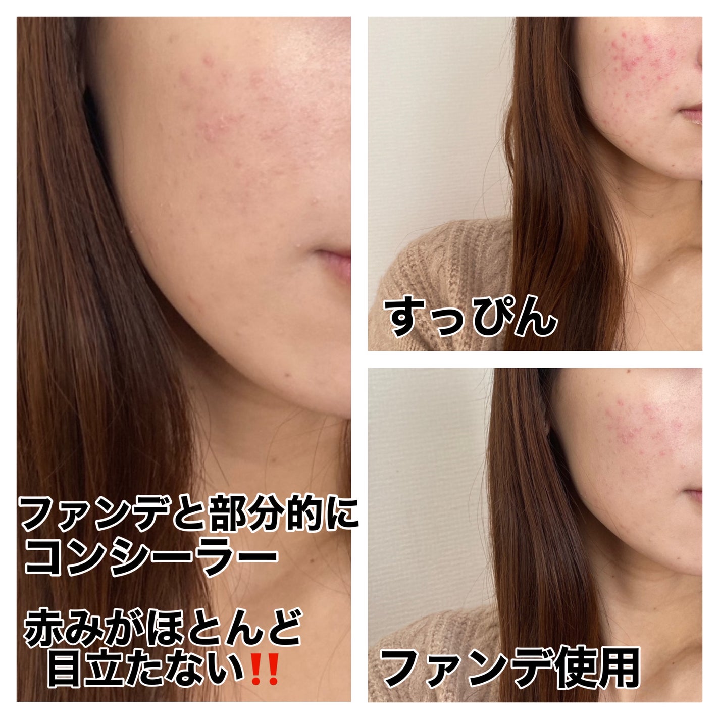 エッセンス スキングロウ ファンデーション/SHISEIDO/リキッドファンデーションを使ったクチコミ(5枚目)