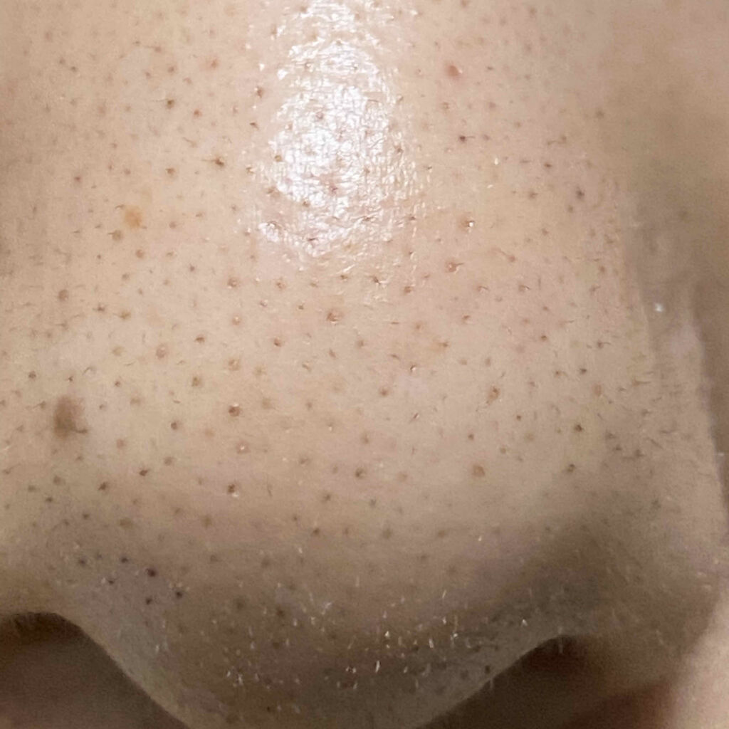 ハトムギ化粧水(ナチュリエ スキンコンディショナー R )/ナチュリエ/化粧水を使ったクチコミ（3枚目）