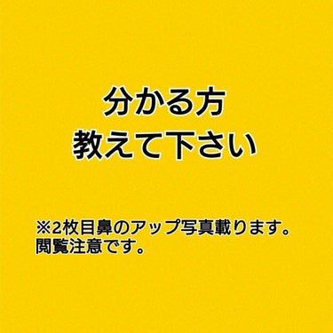 ぐり on LIPS 「皆様こんばんは、ぐりです。本日は、ずっと悩んでいることを分かる..」（1枚目）