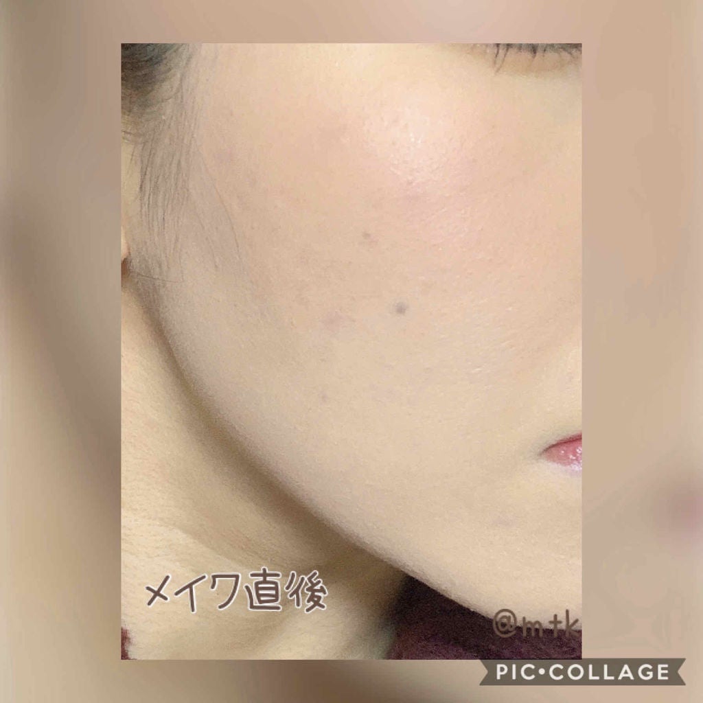 ミノン アミノモイスト モイストチャージ ミルク/ミノン/乳液を使ったクチコミ(2枚目)