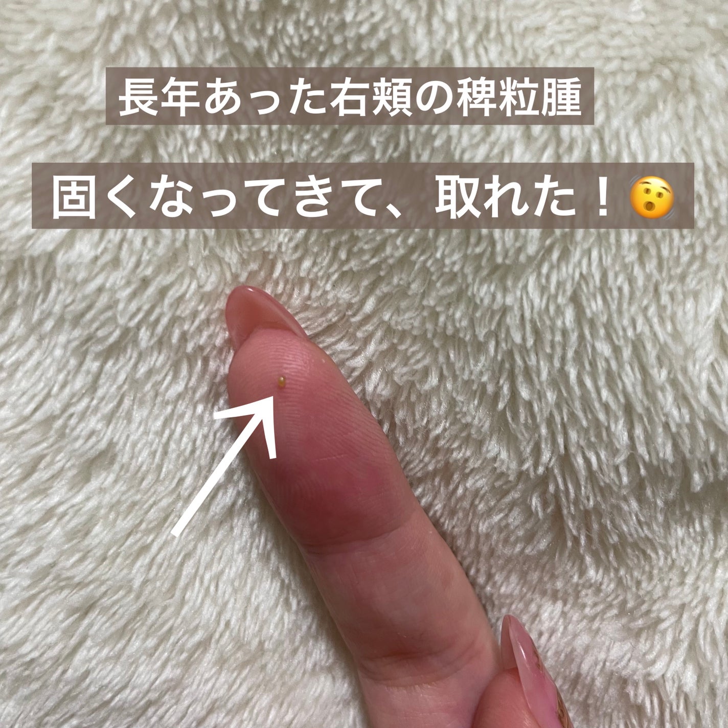 RXザ・ビタミンC23セラム/COSRX/美容液を使ったクチコミ(2枚目)