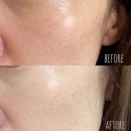 スキンブレミッシュバーム/Cell Fusion C(セルフュージョンシー)/化粧下地を使ったクチコミ(3枚目)