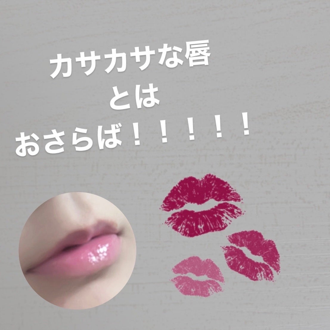 モアリップ N (医薬品)/資生堂薬品/その他を使ったクチコミ(1枚目)