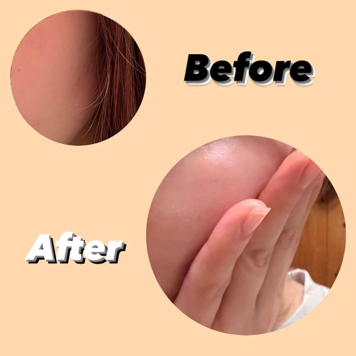 CBDスキンオイル/kalm/フェイスオイルを使ったクチコミ(5枚目)