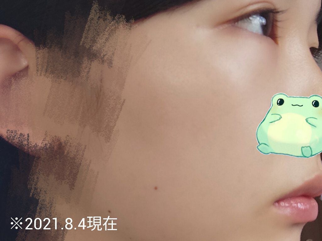 ハトムギ化粧水(ナチュリエ スキンコンディショナー R )/ナチュリエ/化粧水を使ったクチコミ(2枚目)