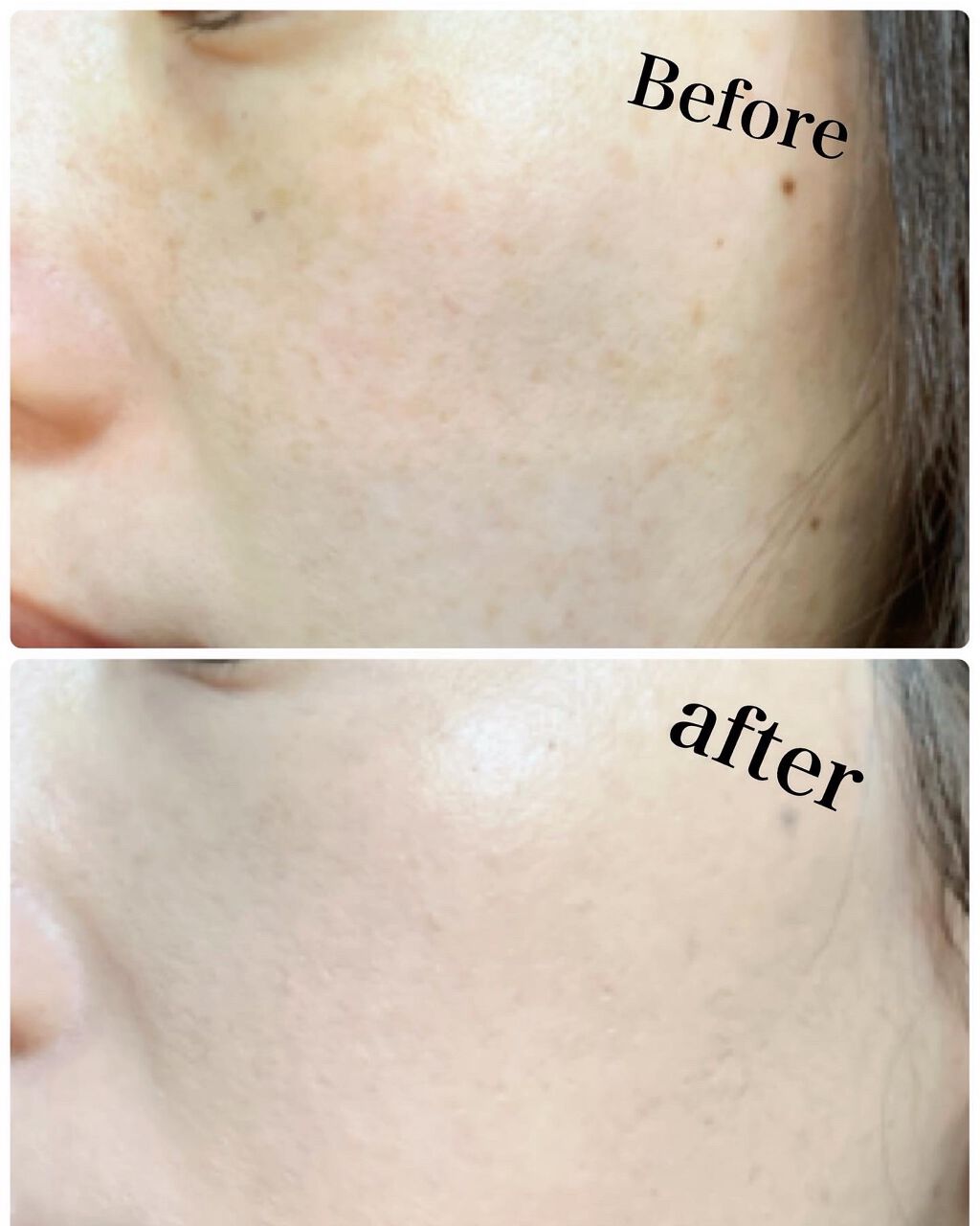 ピンクティーツリーカバークッション/APLIN/クッションファンデーションを使ったクチコミ(4枚目)