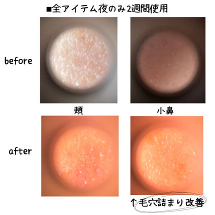 CICA クリーム/VT/フェイスクリームを使ったクチコミ(4枚目)