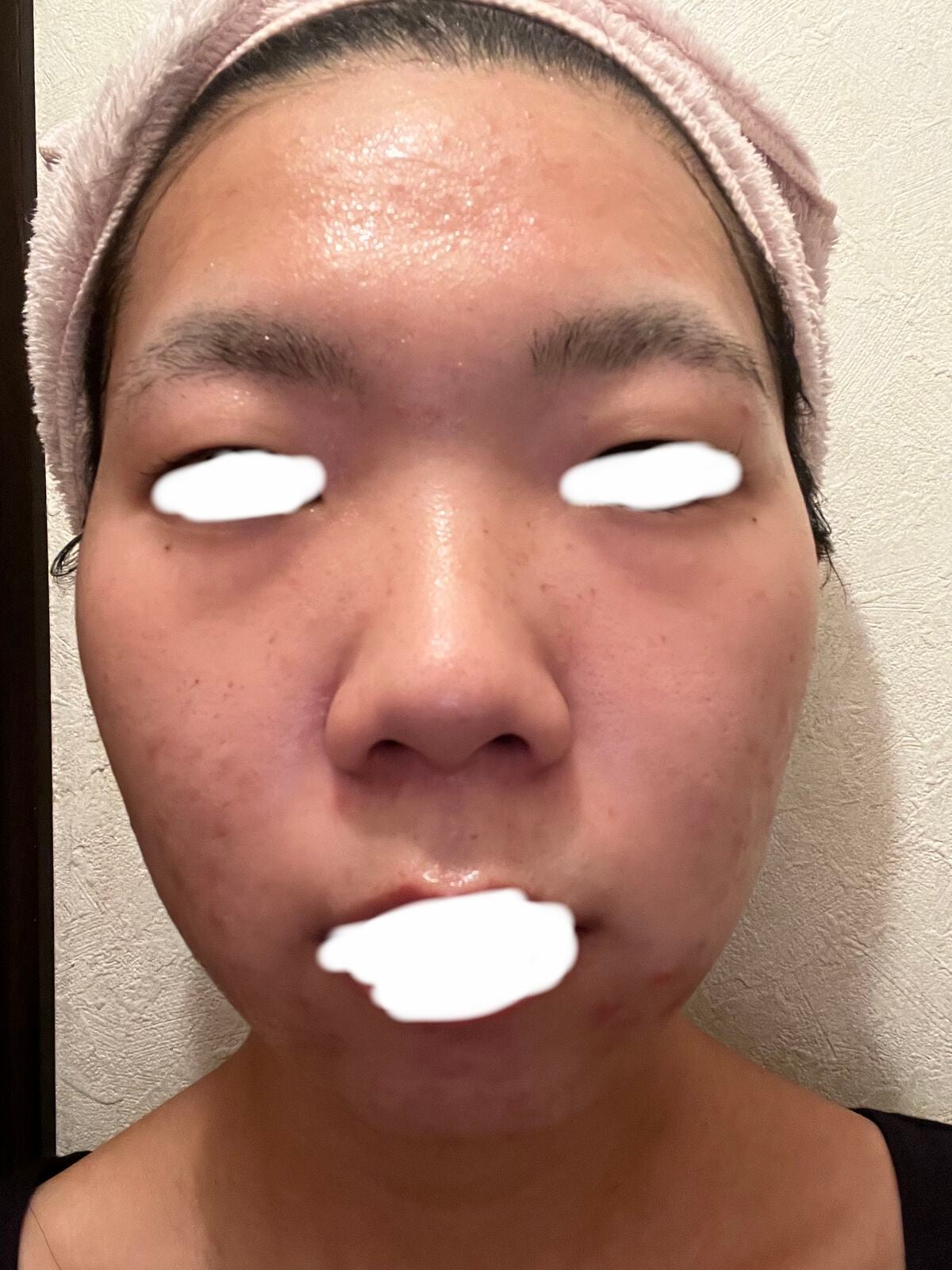 ルルルン ハイドラ V マスク/ルルルン/シートマスク・パックを使ったクチコミ(4枚目)