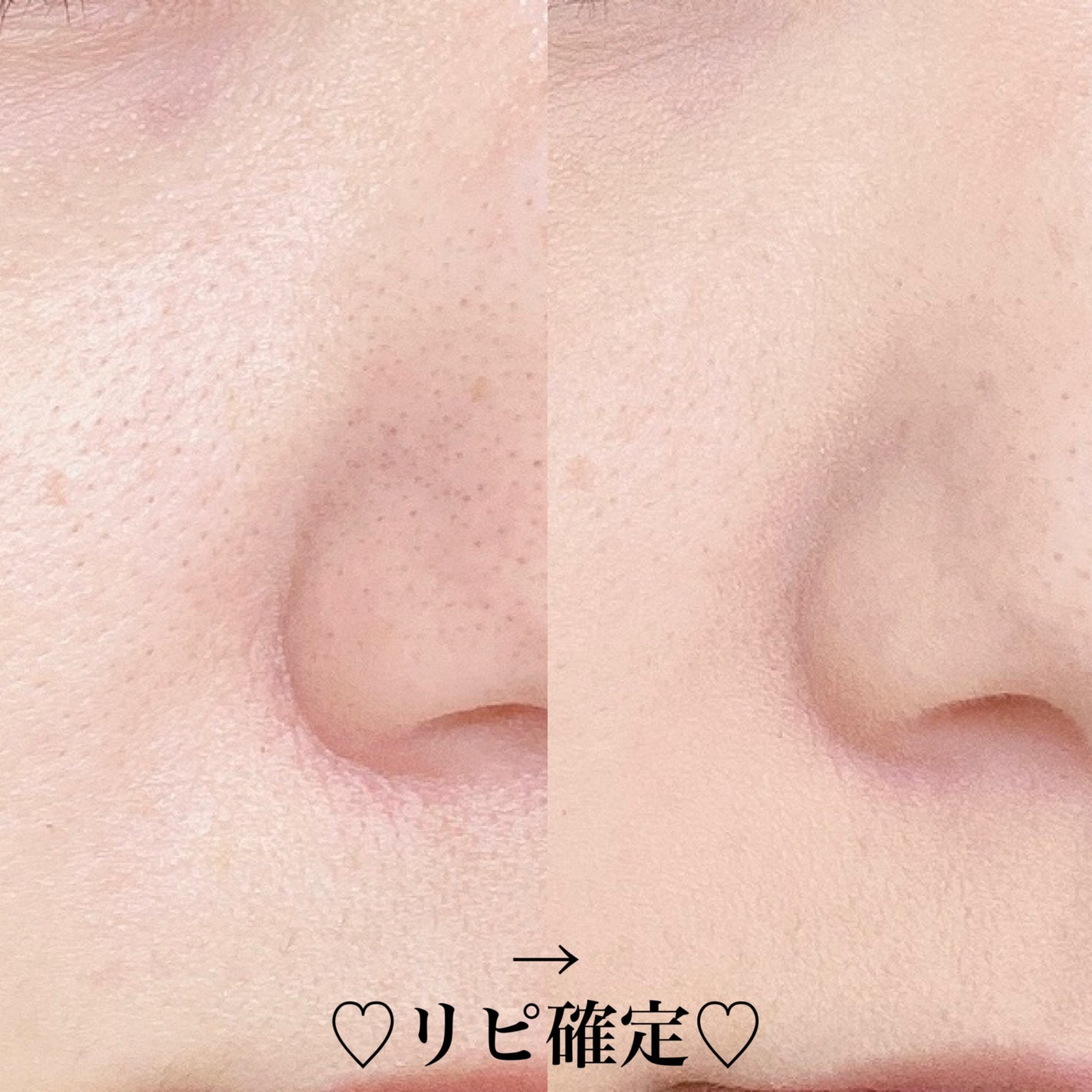 マシュマロフィニッシュパウダー/キャンメイク/プレストパウダーを使ったクチコミ(4枚目)