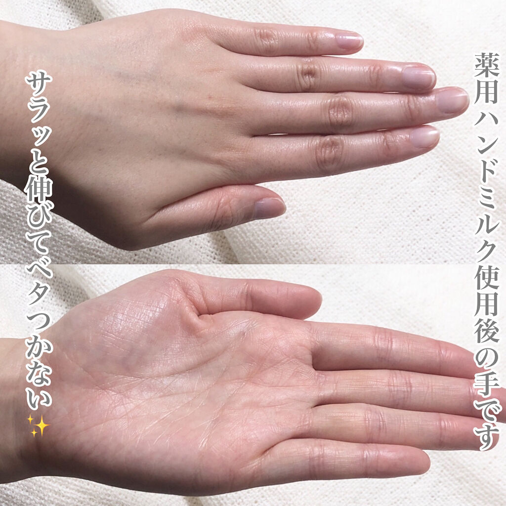 薬用ハンドミルク テトラケア/テトラケア/ハンドクリームを使ったクチコミ（3枚目）