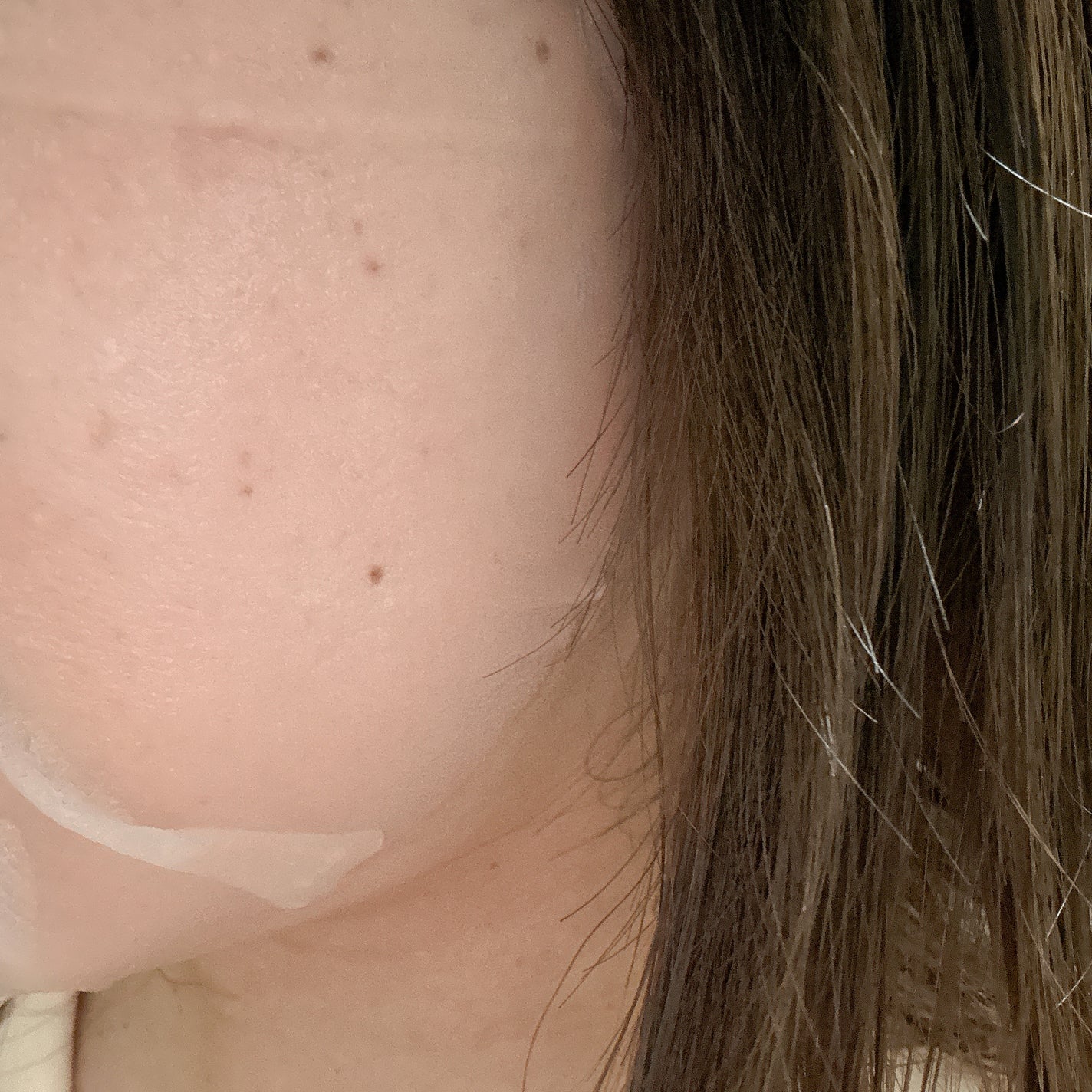 ダーマレーザースーパーVC100マスク/クオリティファースト/シートマスク・パックを使ったクチコミ(3枚目)