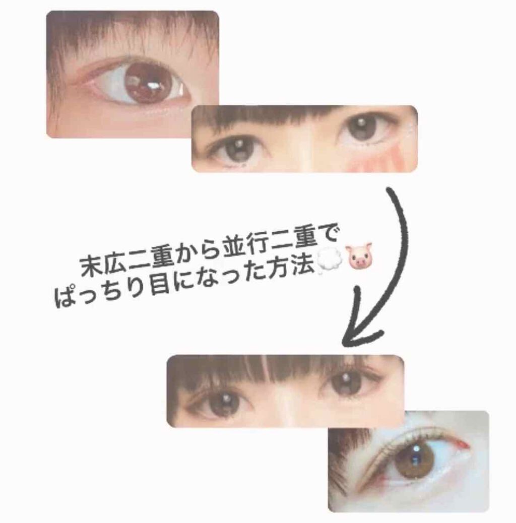 オロナインH軟膏 (医薬品)/オロナイン/その他を使ったクチコミ(1枚目)