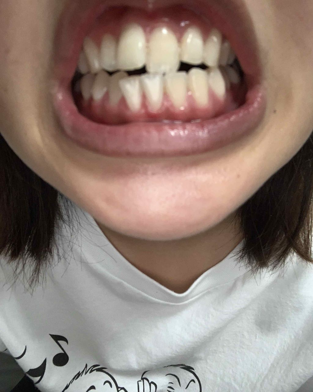 クレスト3Dホワイトニング ホワイトストリップ プロフェッショナル エフェクツ/クレスト/その他オーラルケアを使ったクチコミ（3枚目）