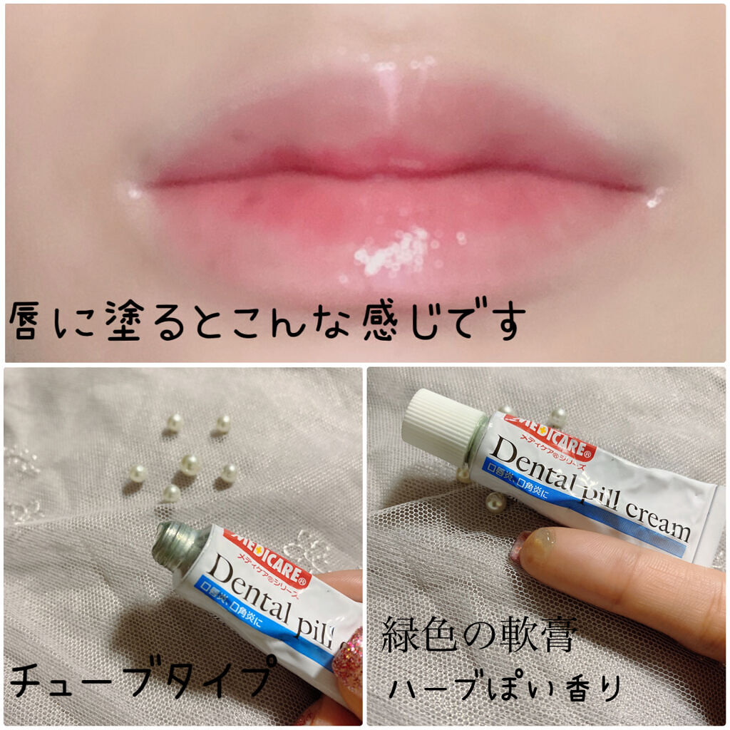 デンタルピルクリーム(医薬品)/メディケア/その他を使ったクチコミ（2枚目）