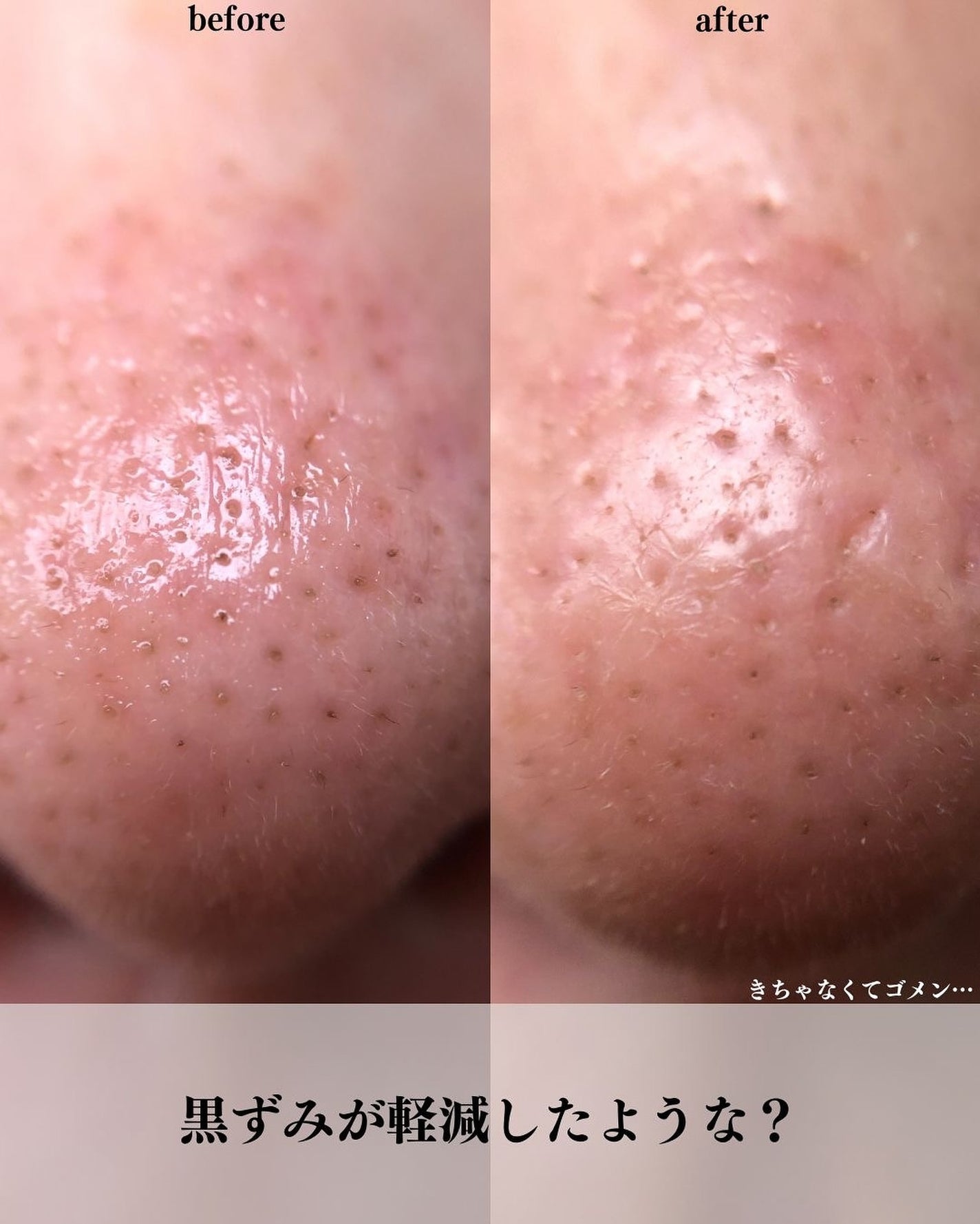 ゼロ毛穴クレイパック/MEDICUBE/洗い流すパック・マスクを使ったクチコミ(7枚目)