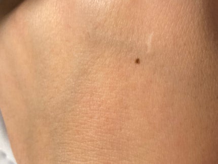 クレヨンコンシーラー/チャコット・コスメティクス/ペンシルコンシーラーを使ったクチコミ(5枚目)