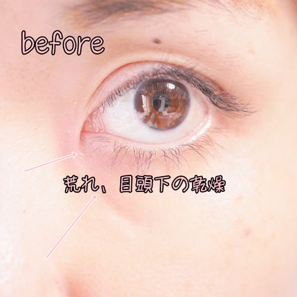 ファイン100/imini/美容液を使ったクチコミ(7枚目)