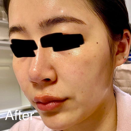 ザビタミンC23/IOPE/美容液を使ったクチコミ(4枚目)