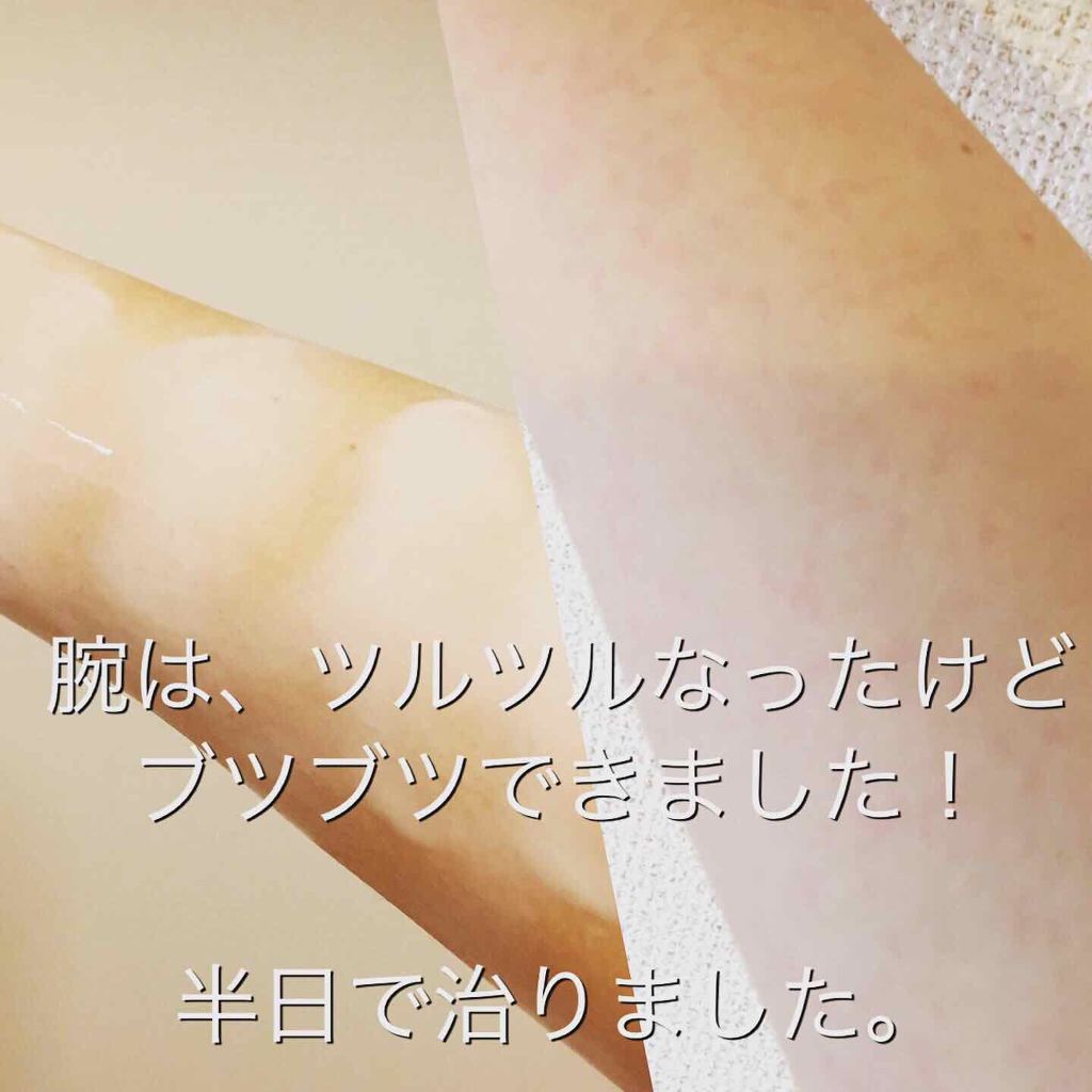 ヌーク除毛ミルクローション/ヌーク/除毛クリームを使ったクチコミ（2枚目）