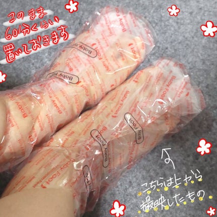 イージーパックDP60分タイプ/ベビーフット/レッグ・フットケアを使ったクチコミ(8枚目)