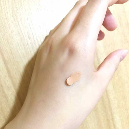 にきび治療薬C(医薬品)/ピンプリット/その他を使ったクチコミ(2枚目)